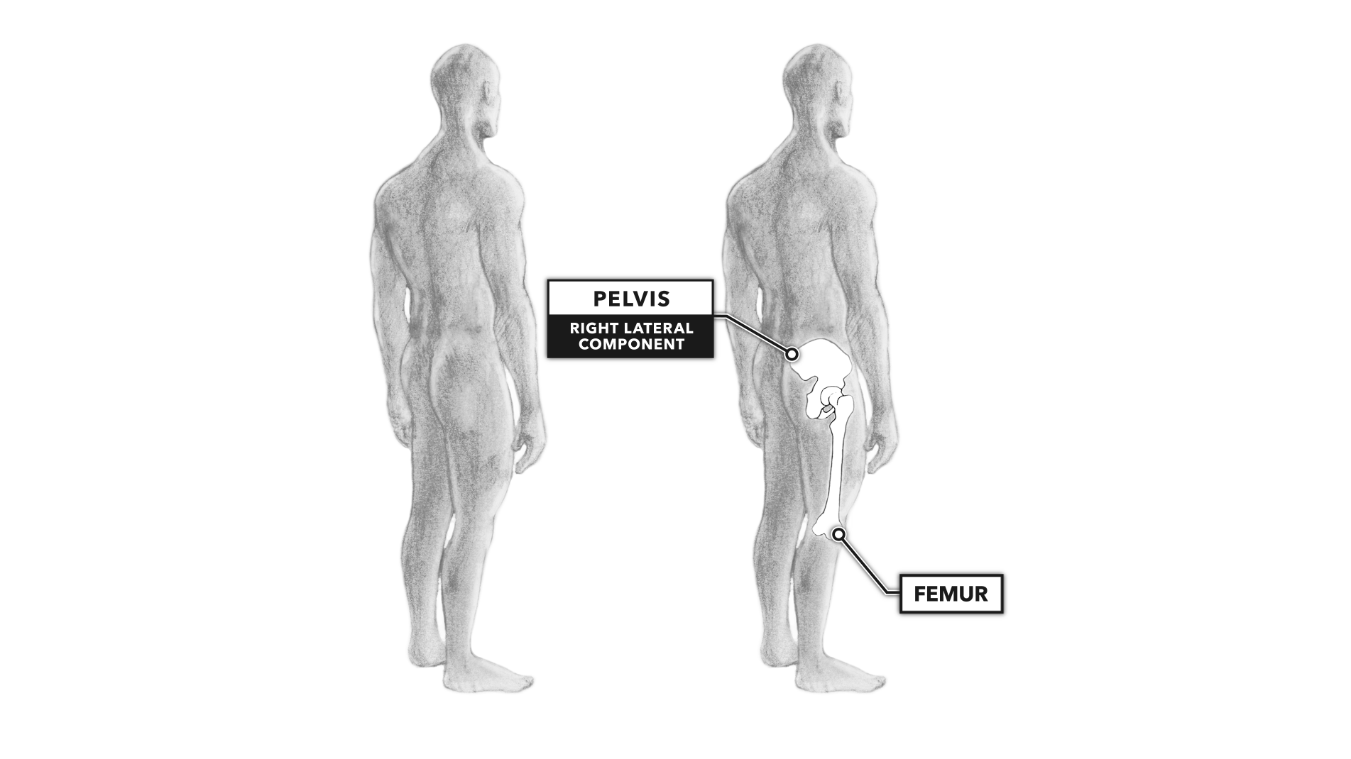 back extension vs flexion