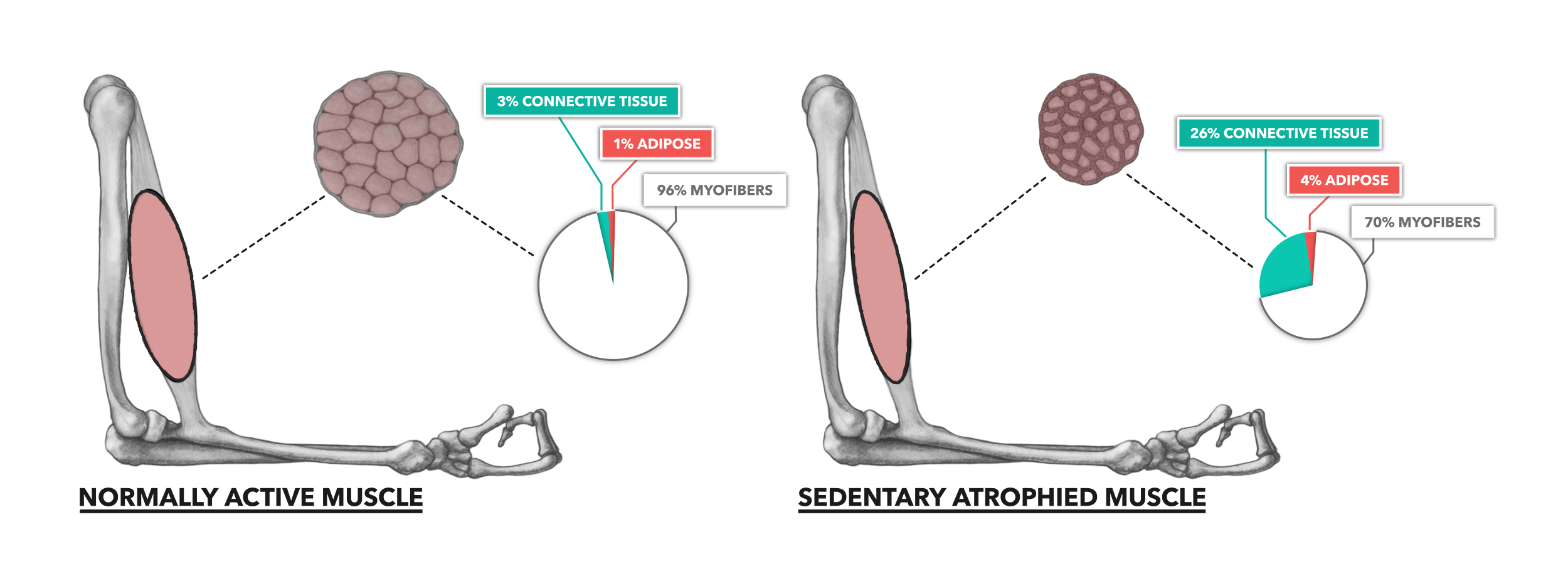 CrossFit | Muscle Basics, Part 4: Atrophy & Sarcopenia