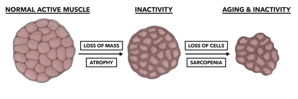 Princípios Musculares: Atrofia E Sarcopenia - Inbox Crossfit