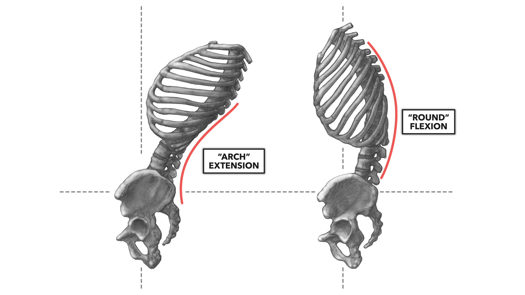 Arched Back Definition