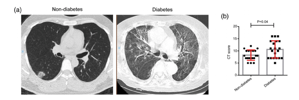 CrossFit | Diabetes Is a Risk Factor for the Progression and Prognosis ...